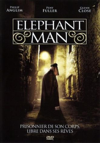 Человек-слон (фильм 1982)