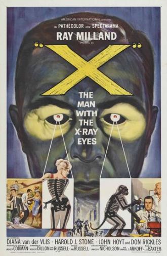 Человек с рентгеновскими глазами (фильм 1963)