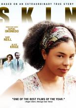 Скин (2008)